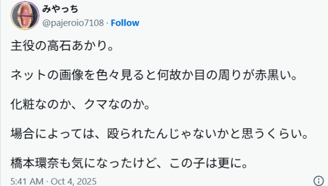 高石あかりの目のクマが話題に？